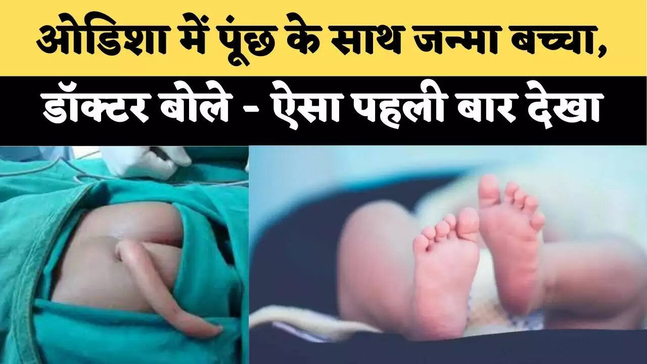 ओडिशा में पूंछ के साथ जन्मा बच्चा, डॉक्टर बोले – ऐसा पहली बार देखा
