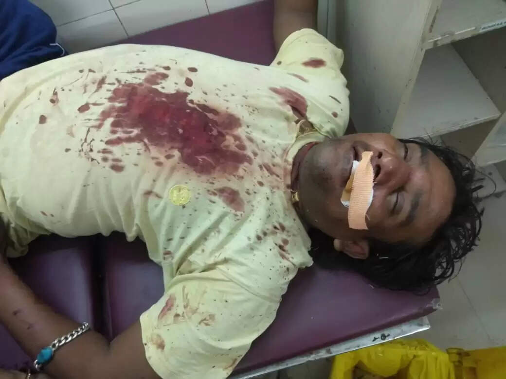 सेंट्रल जेल वन के सामने दो पक्ष भिड़े, चाकू और डंडे चले, चार हुए जख्मी