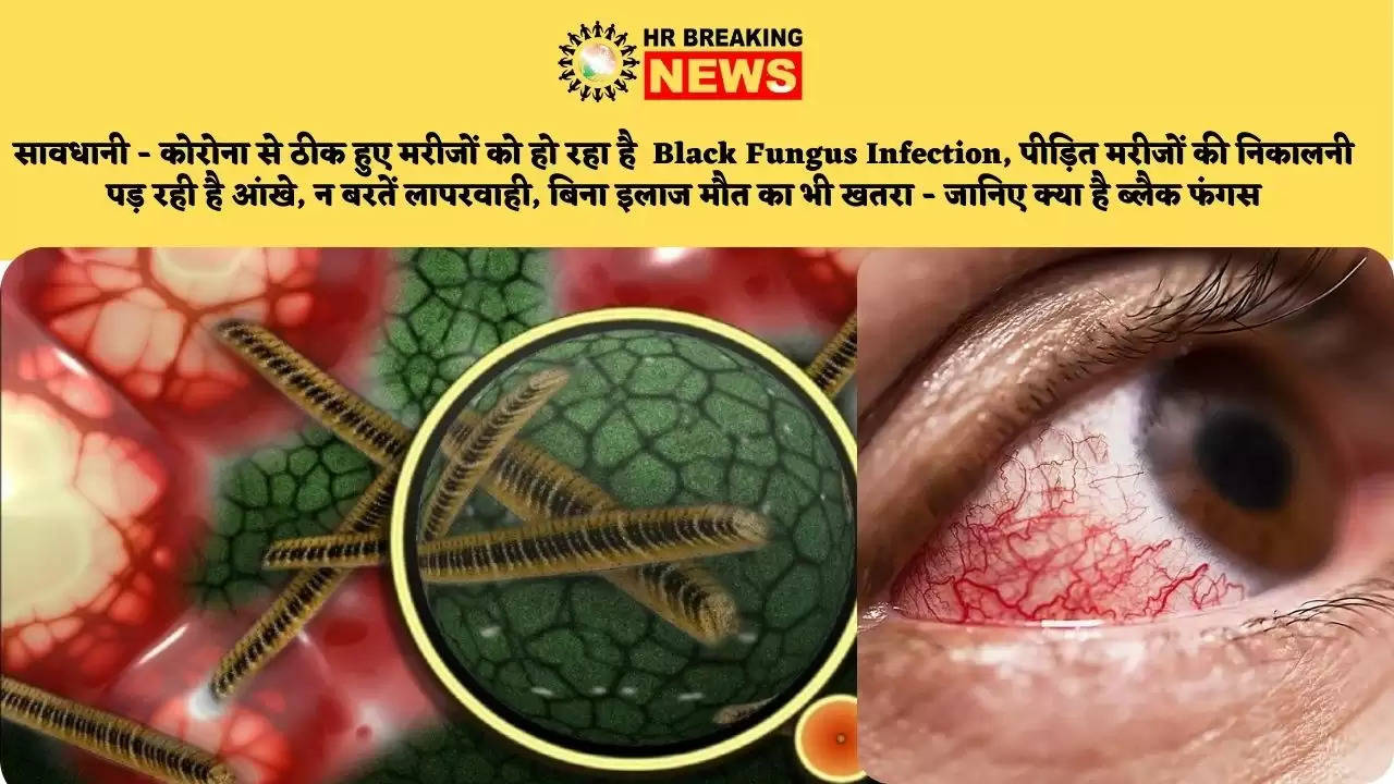 सावधानी – कोरोना से ठीक हुए मरीजों को हो रहा है  Black Fungus Infection, पीड़ित मरीजों की निकालनी पड़ रही है आंखे, न बरतें लापरवाही, बिना इलाज मौत का भी खतरा – जानिए क्या है ब्लैक फंगस