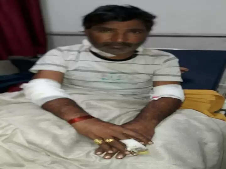 पति ने कपड़े धोने को कहा तो पत्नी ने उस पर डाल दिया उबलता पानी। HR BREAKING NEWS