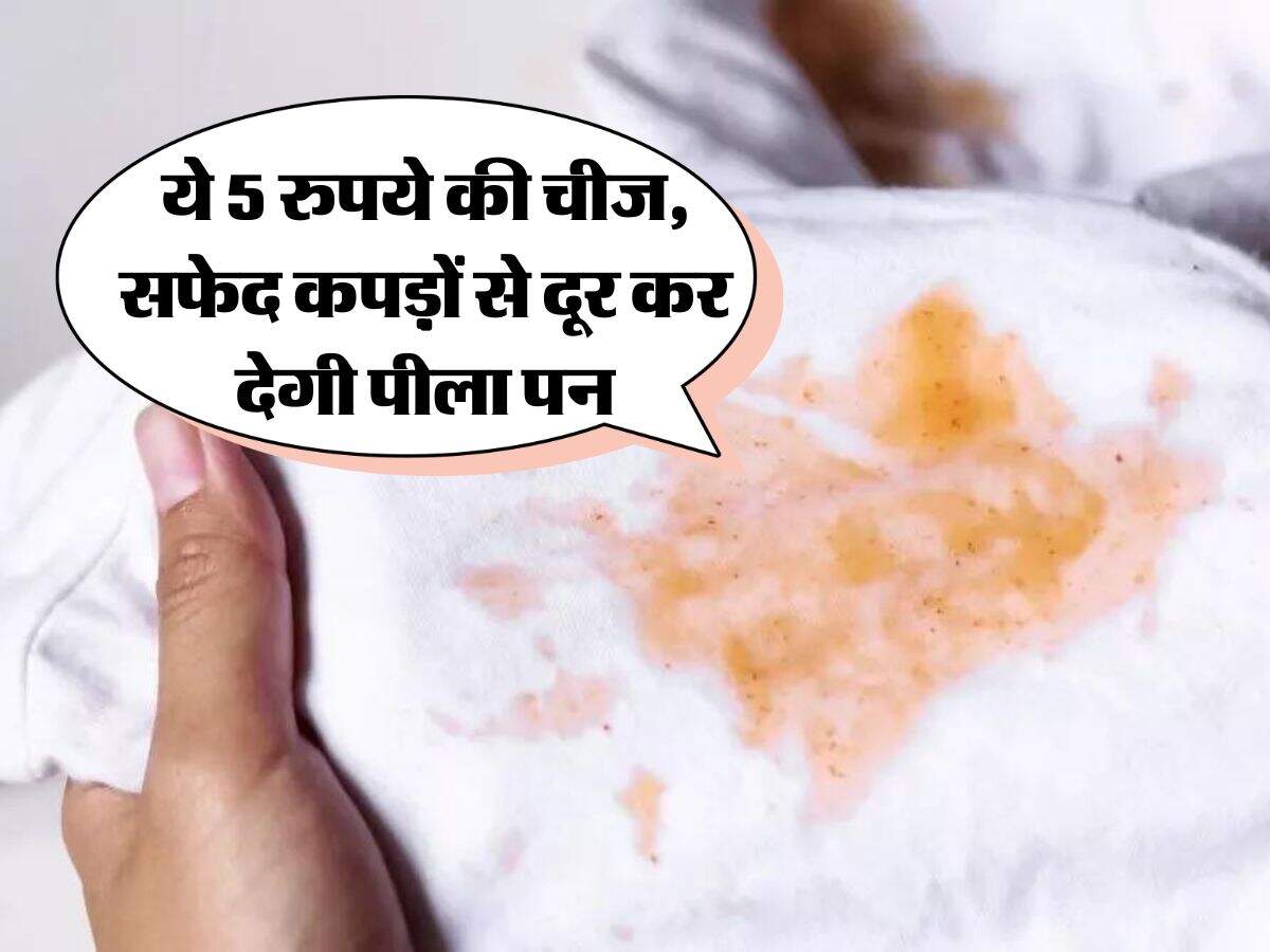 Remove stain from clothes: ये 5 रुपये की चीज, सफेद कपड़़ों से दूर कर देगी पीला पन
