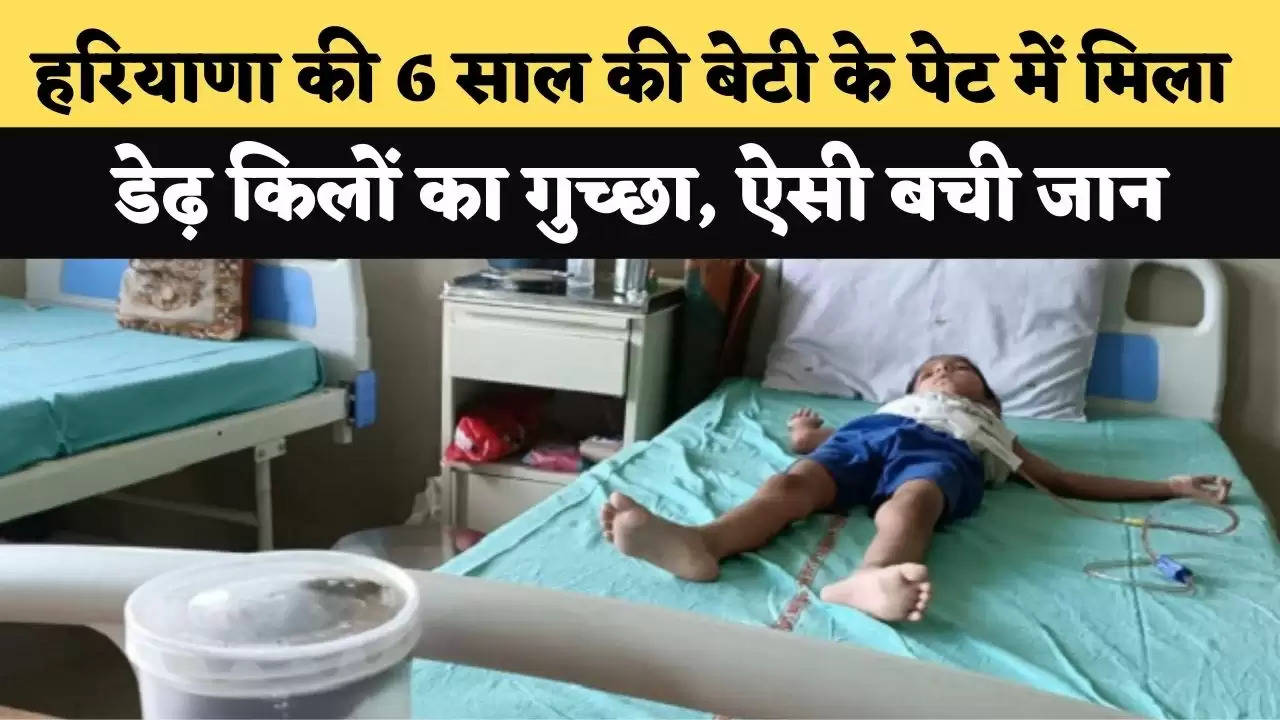 हरियाणा की 6 साल की बेटी के पेट में मिला डेढ़ किलों गुच्छा, बचपन में खाती थी बाल