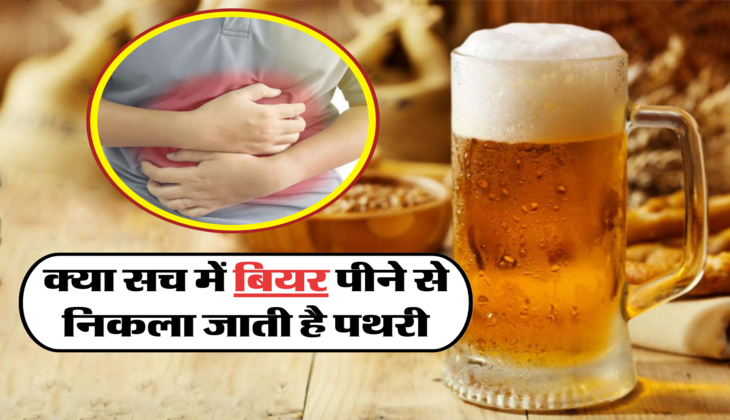 क्या सच में बियर पीने से निकला जाती है पथरी