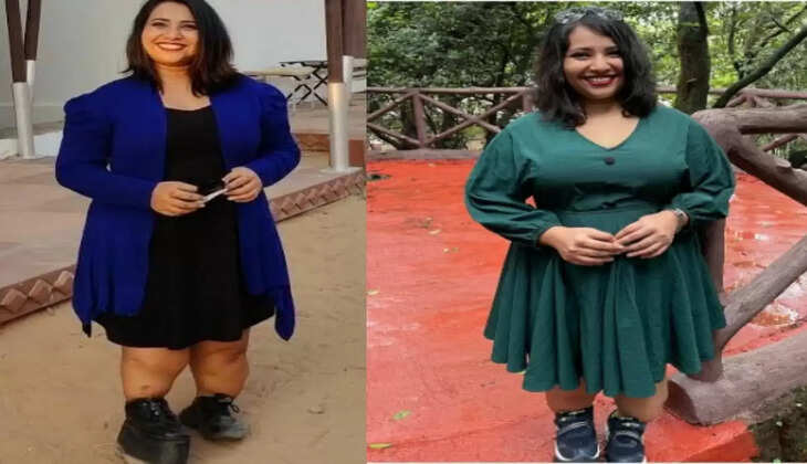 30 साल की उम्र में 15 सर्जरी झेलने के बाद भी नही टूटा हौसला, Success Business Woman बन कर ही मानी ये महिला