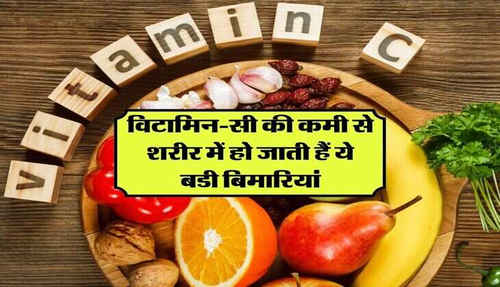विटामिन-सी की कमी से शरीर में हो जाती हैं ये बडी बिमारियां, आज हो जाएं सतर्क